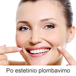 Estetinis plombavimas Kaune
