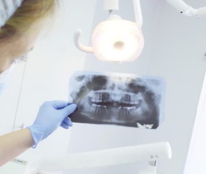 Faktai apie implantus