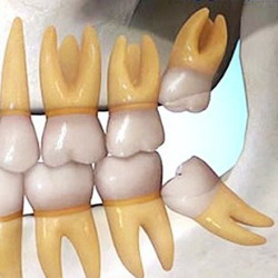 Protiniai dantys